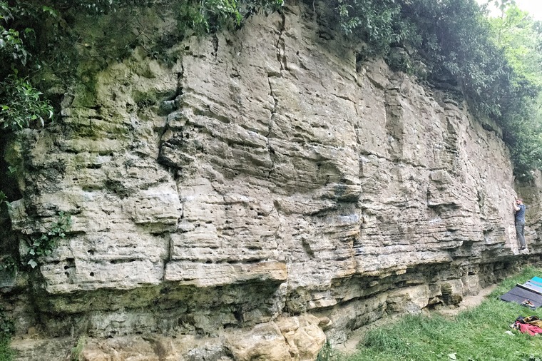 Sector 1/Lipo Suction