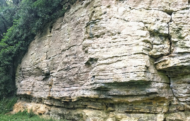 Sector 1/Lipo Suction