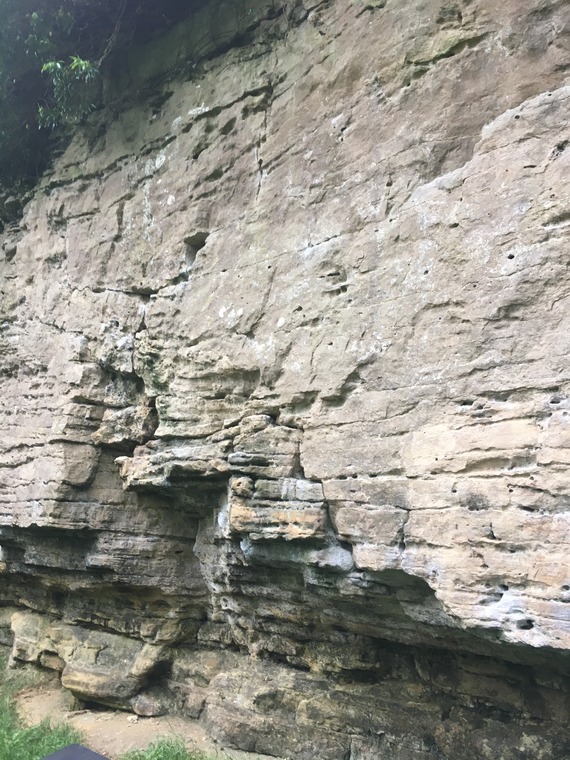 Sector 1/Lipo Suction