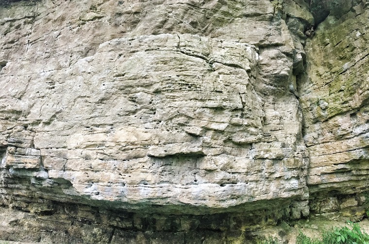 Sector 1/Lipo Suction