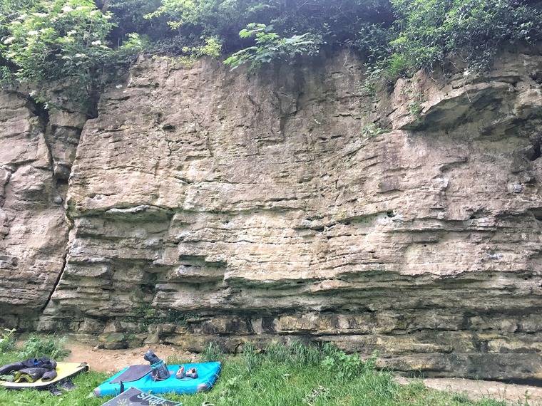 Sector 1/Lipo Suction